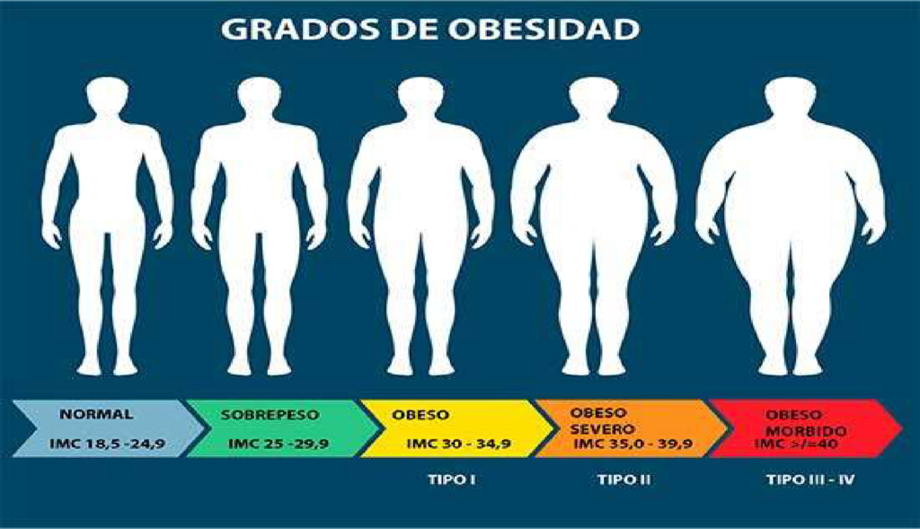 Obesidad aun no es reconocida como una enfermedad entre la población