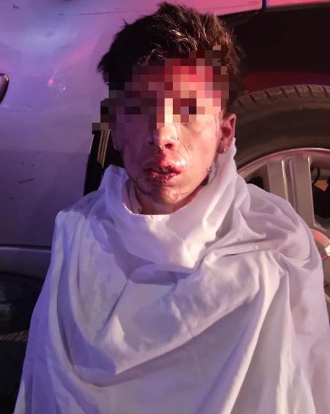 Incendiario de transporte de personal,  resultó lesionado y detenido