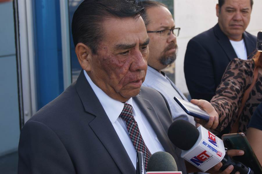 Nunca ha habido alerta en elecciones; esta vez no será la excepción; Martín Chaparro.